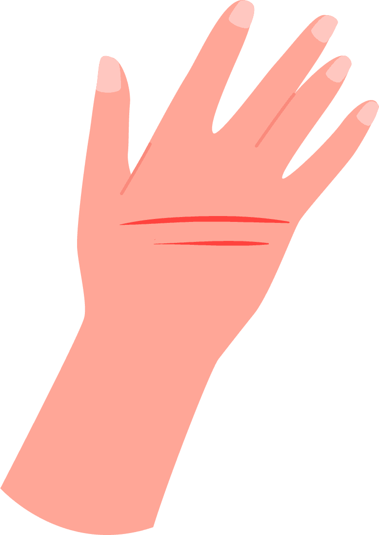 <p>Bersihkan luka dengan [wund] Wound Spray secara menyeluruh</p>